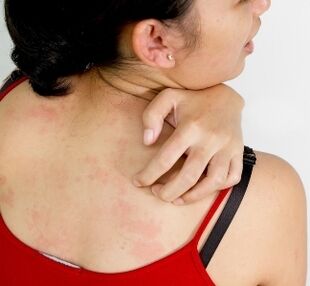 granulomak gorputzean - parasitoen presentzia sintomak