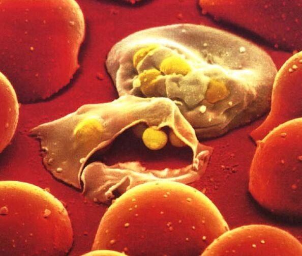 parasito sinpleena malaria plasmodium