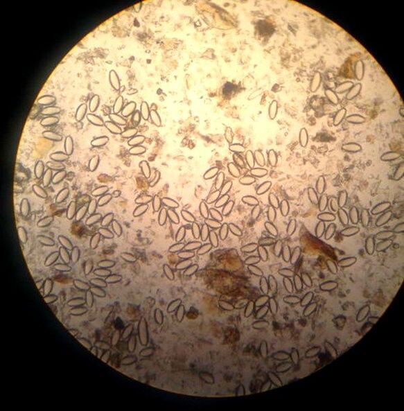 Oxiuroa nematodo parasito eta askea da. 
